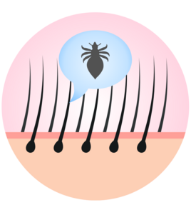 head-lice-graphic