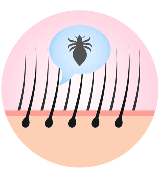 head-lice